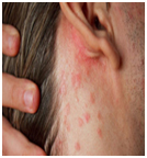 skin diseases homeopathy treatment In Ambawadi Ahmedabad | homeopathic children  diseases In Paldi | Homeopathic treatment for PCOS / PCOD In Ambawadi - Hemraj Homeo Clinic in ambawadi Ahmedabad