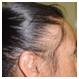 Hair problem homeopathic treatment  In Ambawadi | Homeopathic Hair And Care In Ambawadi | Eye Problem Treatment in ambawadi  Ahmedabad - Hemraj Homeo Clinic in ambawadi Ahmedabad